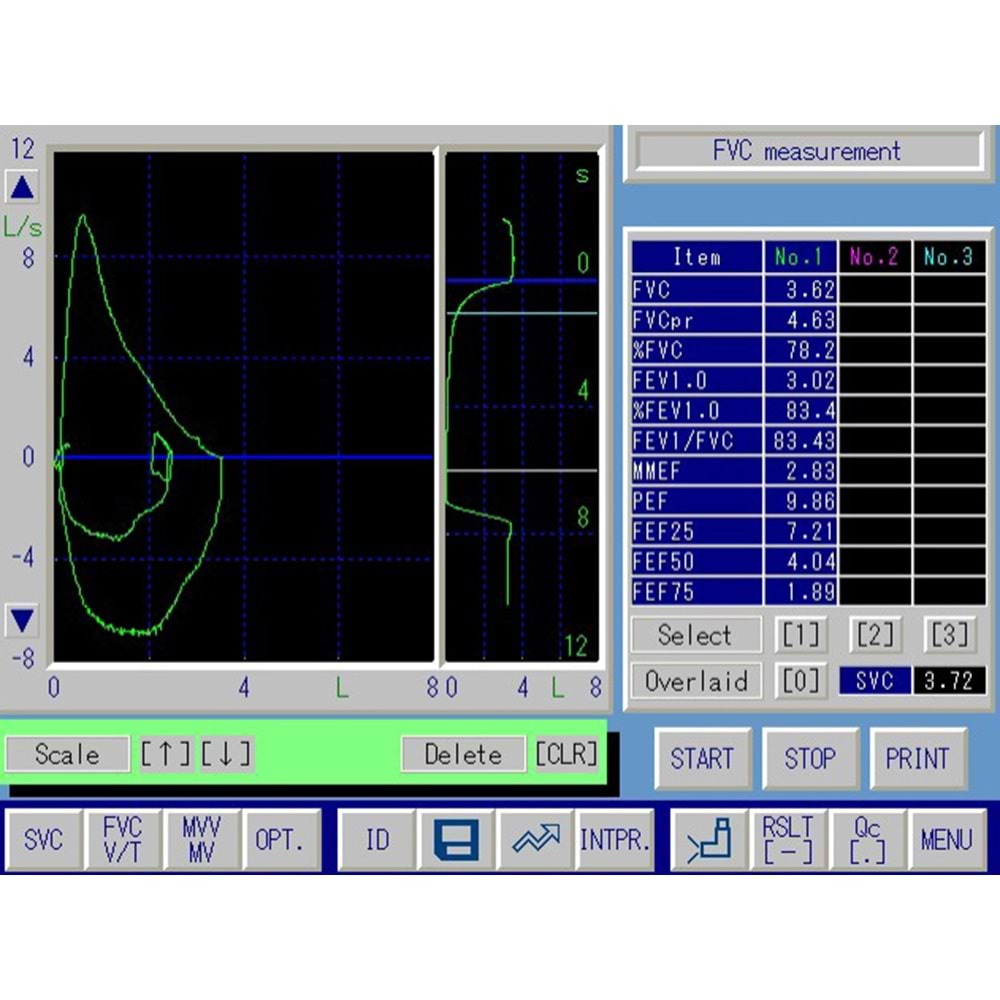 Spirometre Ekranı Chest HI-105