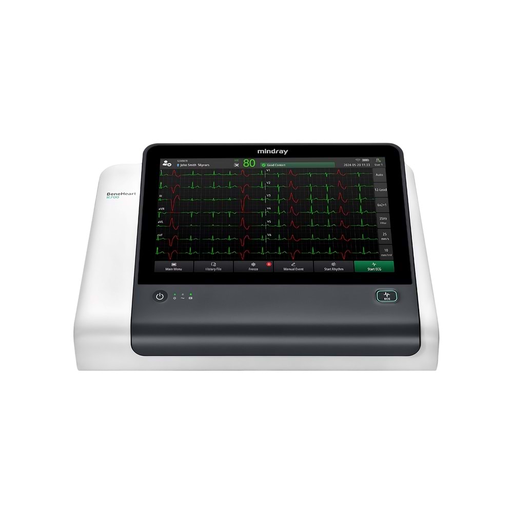 12 Kanallı EKG Cihazı Mindray BeneHeart R700