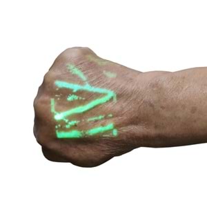 İkinci El Damar Görüntüleme Cihazı Qualmedi QV-500